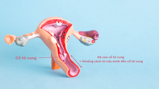 Đo độ cao cổ tử cung giúp bạn lựa chọn cốc nguyệt san đúng size, phù hợp với cơ địa, chống rò rỉ.