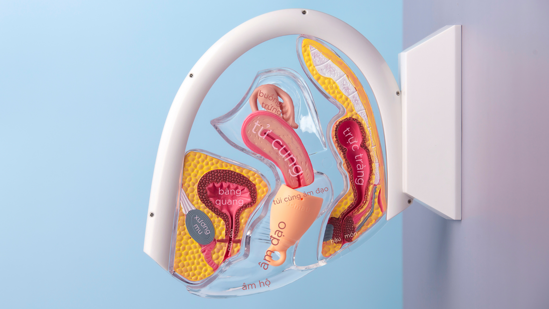 Cốc nguyệt san bị kẹt là tình huống mà ai cũng có thể gặp phải. Nhưng với vị trí của cốc, chiếc cốc không thể bị kẹt vĩnh viễn hay biến mất hẳn vào trong.